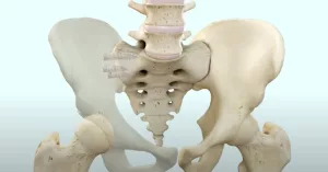 Considering SI Joint Fusion for Chronic Back Pain?