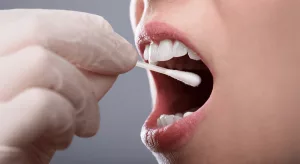 Saliva Disease Markers: Fast, Non‑Invasive Diagnosis