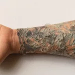 Tattoo Scarring Healing: Real Tips to Keep Ink Smooth Tattoo Scarring Healing: Real Tips to Keep Ink Smooth