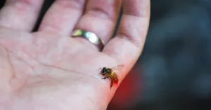 The Bee Sting: Simple Treatments + Natural Fixes That Actually Work