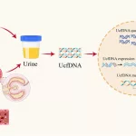 urine tumor DNA: Unlock Smarter Bladder Cancer Care urine tumor DNA: Unlock Smarter Bladder Cancer Care