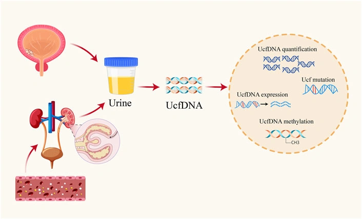 urine tumor DNA: Unlock Smarter Bladder Cancer Care