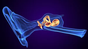 Vestibular hydrops MRI: What it shows, why it matters