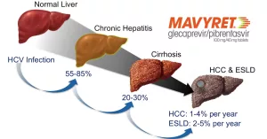 What is Mavyret Used For? Friendly Guide to Hep C Cure What is Mavyret Used For? Friendly Guide to Hep C Cure