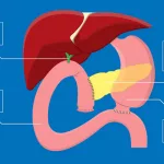 Longest Life After Whipple Surgery: Real Stories And Facts