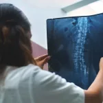 Scoliosis Symptoms: Spot the Signs Early and Take Action
