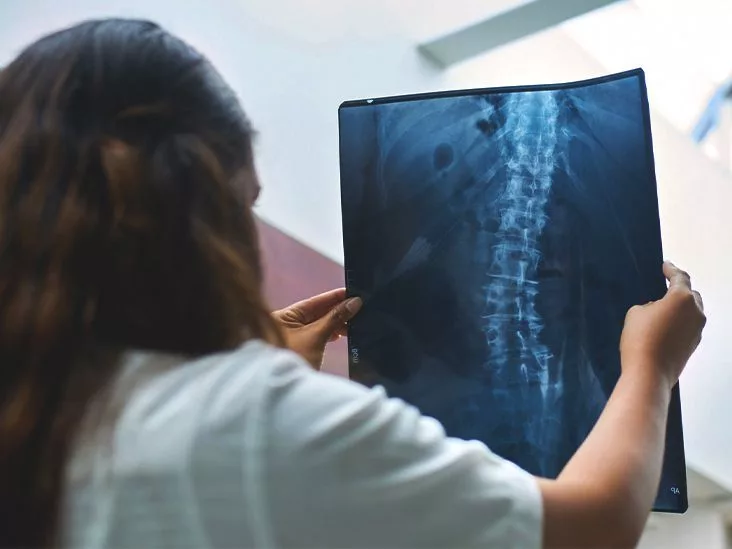 Scoliosis Symptoms: Spot the Signs Early and Take Action