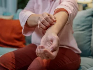 Is Your Lupus Rash Itchy? Find Answers & Relief Today