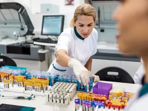 Lupus Blood Tests: How They Diagnose & Monitor