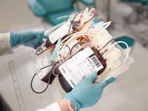 Polycythemia Vera Hereditary? What You Need to Know