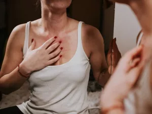 Alcohol Causing Hives: What’s Happening and How to Stop