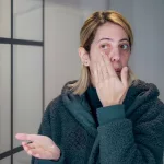 Cutaneous Lupus Erythematosus: Symptoms & Types