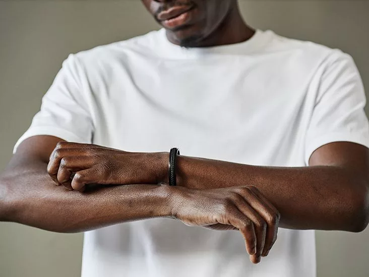 Physical urticaria symptoms: what to watch for