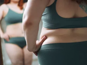 Lupus Weight Gain: Why It Happens and How to Manage