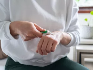 Topical Steroid Withdrawal: How to Recognize & Heal