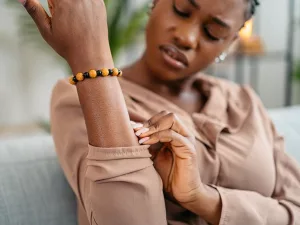 Hives vs Bug Bite: Spot the Difference Fast and Easy