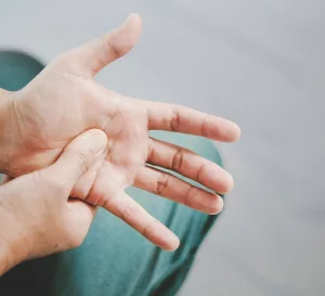 Spotting Early Dupuytren’s Contracture Symptoms