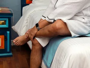 IgA Nephropathy Rash: What It Looks Like & How to Treat