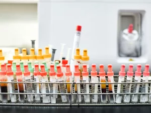 Genetic Testing Macular Degeneration: Is It Worth It?