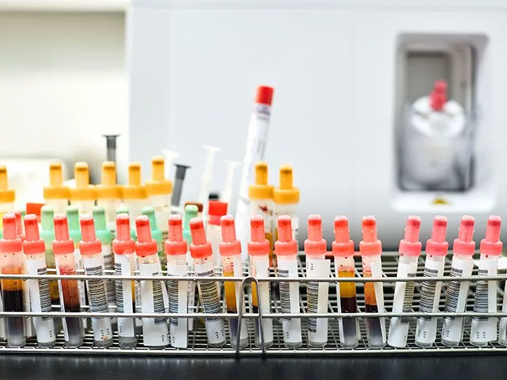 Genetic Testing Macular Degeneration: Is It Worth It?