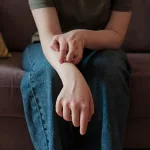 Urticarial Vasculitis: Symptoms, Causes & Treatment