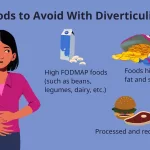 7 Foods to Avoid with Diverticulitis
