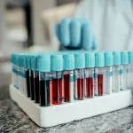 White Blood Cells: Why They Matter for Your Health