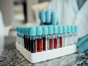 White Blood Cells: Why They Matter for Your Health