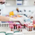 HIV-1 vs HIV-2: Transmission, Diagnosis & Treatment