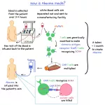 Abecma for Multiple Myeloma: New Hope, Real Talk Abecma for Multiple Myeloma: New Hope, Real Talk