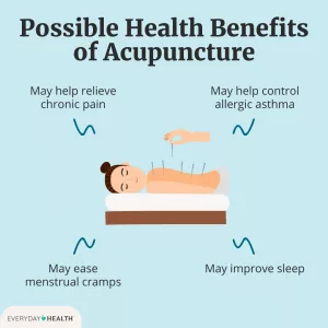 Acupuncture Benefits and Risks: What You Need to Know Before You Try Acupuncture Benefits and Risks: What You Need to Know Before You Try
