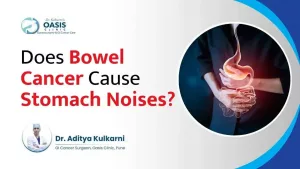 Bowel Cancer Stomach Noises: The Gurgles You Shouldn’t Ignore Bowel Cancer Stomach Noises: The Gurgles You Shouldn’t Ignore