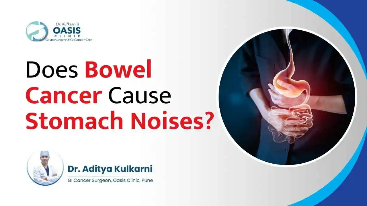 Bowel Cancer Stomach Noises: The Gurgles You Shouldn’t Ignore