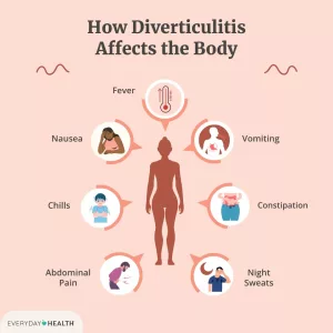 Can Diverticulitis Cause Night Sweatts? How Your Gut Can Mess With Your Sleep Can Diverticulitis Cause Night Sweatts? How Your Gut Can Mess With Your Sleep