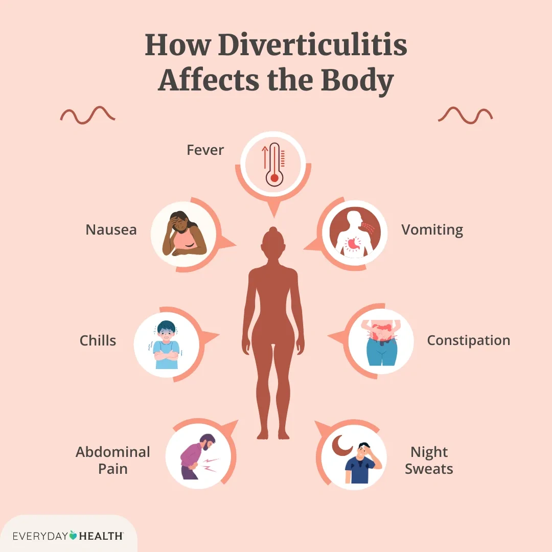 Can Diverticulitis Cause Night Sweatts? How Your Gut Can Mess With Your Sleep