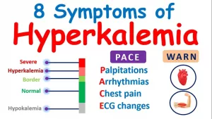 Can High Potassium Cause Seizures? Unpacking The Unexpected Link