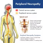 Can You Become Paralyzed from Peripheral Neuropathy? Let’s Talk Symptoms, Fears, and Hope Can You Become Paralyzed from Peripheral Neuropathy? Let’s Talk Symptoms, Fears, and Hope