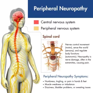 Can You Become Paralyzed from Peripheral Neuropathy? Let’s Talk Symptoms, Fears, and Hope