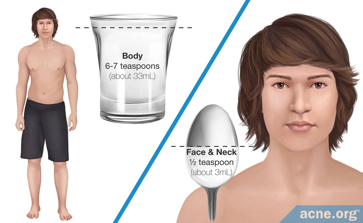 Can You Use Body Sunscreen on Your Face for Acne? Here’s the Real Deal