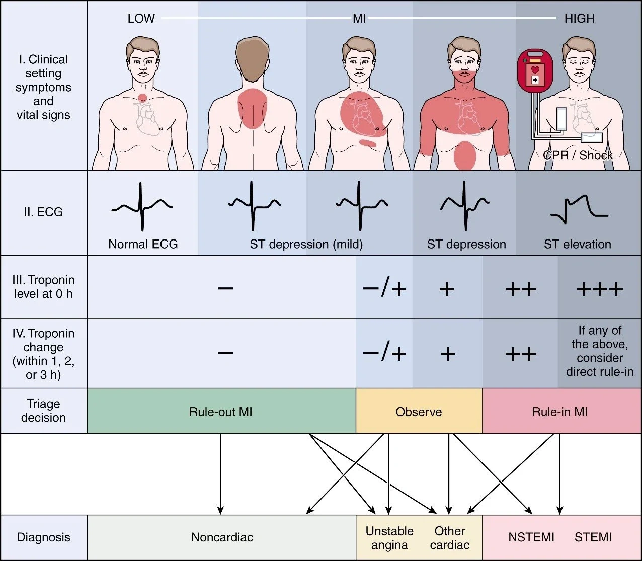 Decode Chest Pain: The Chest Pain Location Chart You’ll Actually Use