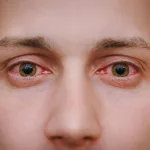 Understanding the Types of Conjunctivitis: Clear Guide