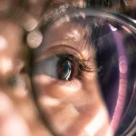 How Dry Eyes Affect Vision – Symptoms, Risks & Relief