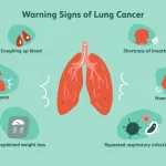 Cough When Laughing Cancer Risk