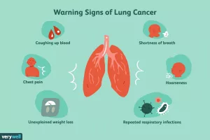 Cough When Laughing Cancer: Why That Nagging Cough Isn’t Always a Joke