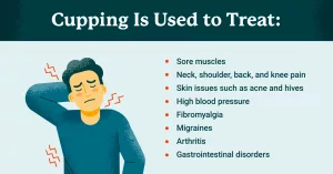 Dangers of Cupping: What They Don’t Tell You at the Spa