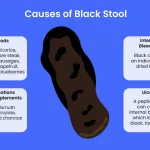 Dark Stools in Adults Photography Causes