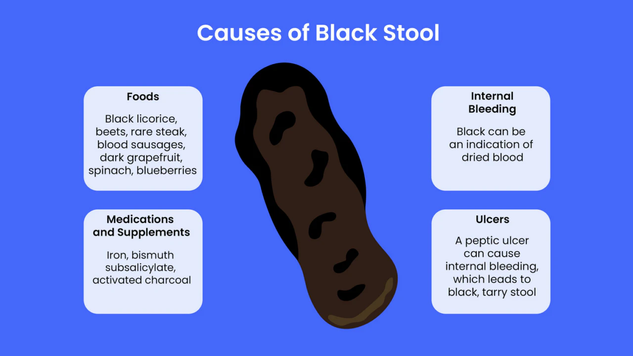 Dark Stools in Adults Photography: The Surprising Story Behind the Color
