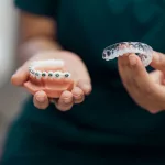 Aligners vs Braces: Which Option Fits Your Life?