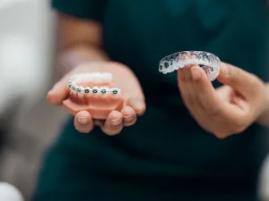 Aligners vs Braces: Which Option Fits Your Life?