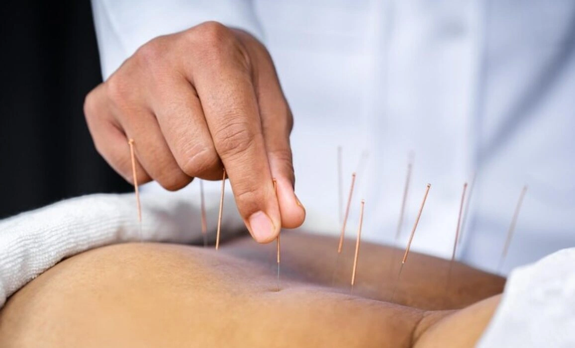 Disadvantages of Acupuncture You’ll Wish You Knew First
